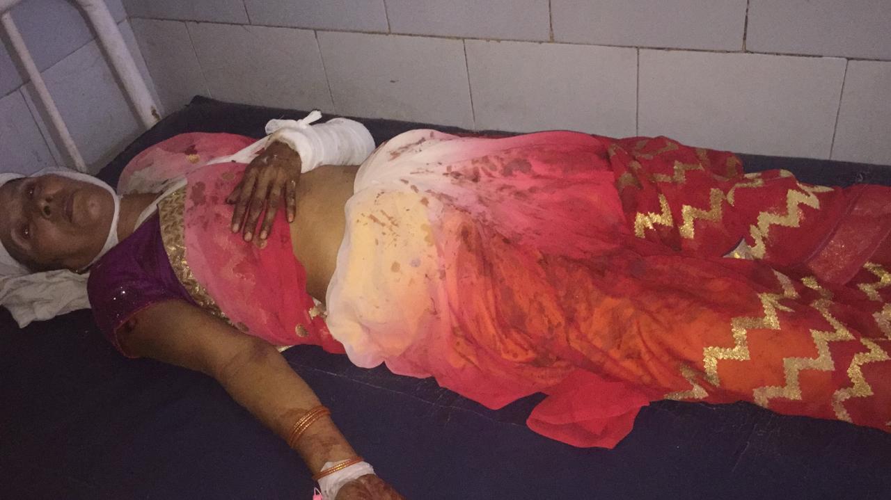 प्रयागराज: लाडले बेटे ने दारू के नशे में धुत होकर किया लाठी से मा पर जान लेवा हमला
