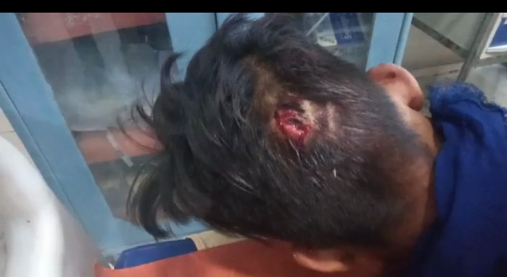 बरेली-मामूली विवाद में बरसे ईंट पत्थर,कई घायल