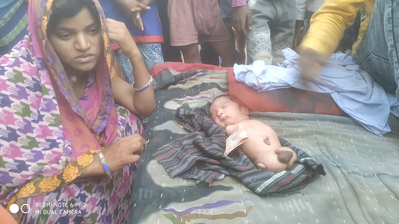 सीतापुर : अद्भुत बच्चे ने लिया जन्म ,देखने उमड़ी भीड़