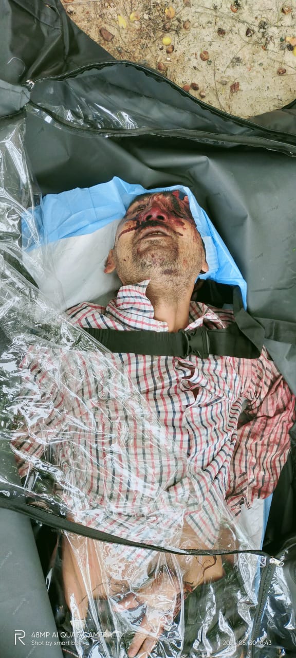 रायबरेली:अज्ञात युवक की ट्रेन से कटकर हुई मौत