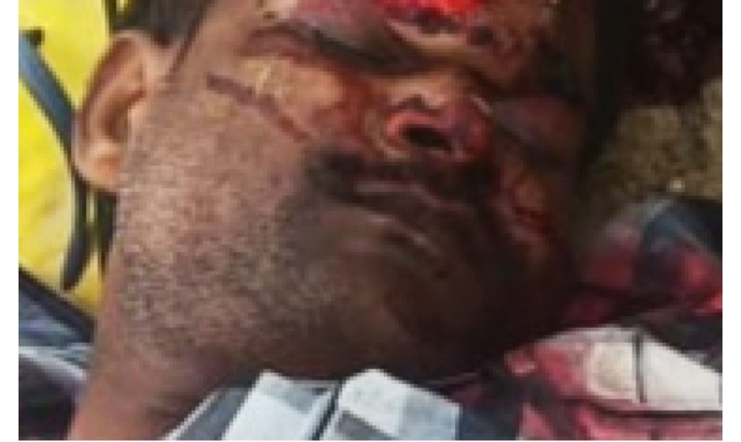 फर्रुखाबाद: रेलवे ट्रैक पर संदिग्ध परिस्थितियों में युवक का शव मिलने पर मचा कोहराम हत्या की आशंका