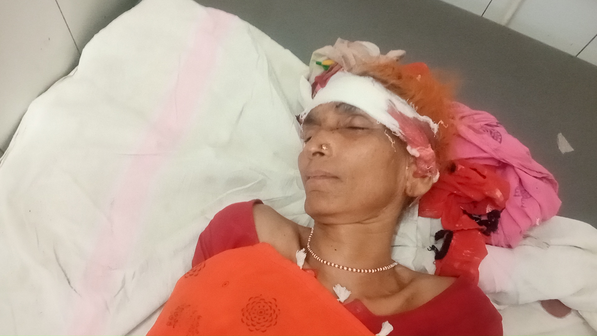 शिवपुरी:सब्जी लेने जा रही महिला में अज्ञात ऑटो ने मारी टक्कर, हालात गंभीर