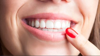मसूड़ों के कालेपन से हैं परेशान तो करे यह टिप्स फॉलो
