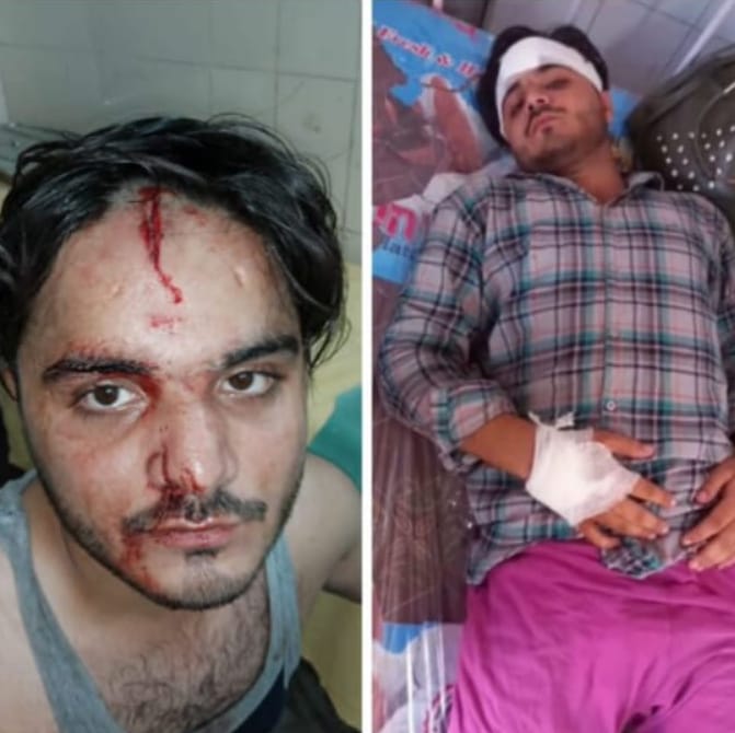 बरेली :युवक पर हुआ जानलेवा हमला पुलिस कर रही लापरवाही