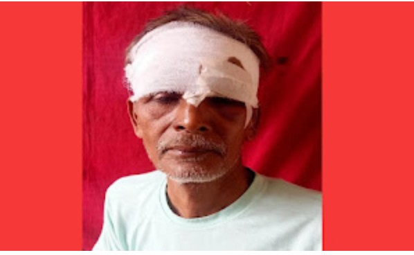 बरेली :भाजपा नेता को टक्कर मार अज्ञात वाहन ने किया घायल