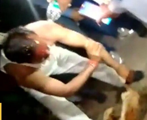 मध्य प्रदेश में मंत्रीजी को लगा दिया खुजली वाला पाउडर, कार्यक्रम छोड़कर नहाने को हो गए मजबूर