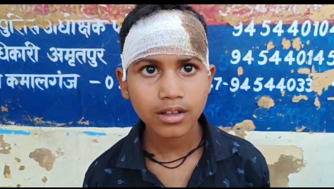 फर्रुखाबाद : दबंग प्रधान ने मासूम पर ट्राली के डाला की कील चुराने का लगाया आरोप मासूम को जमकर पीटा