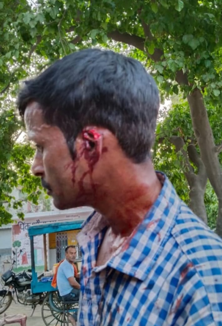 बरेली - मीरगंज में एक दबंग युवक ने दलित युवक का कान काट कर किया घायल।
