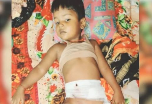 पीलीभीत में खौलते तेल की कढ़ाई में गिरा तीन साल का मासूम