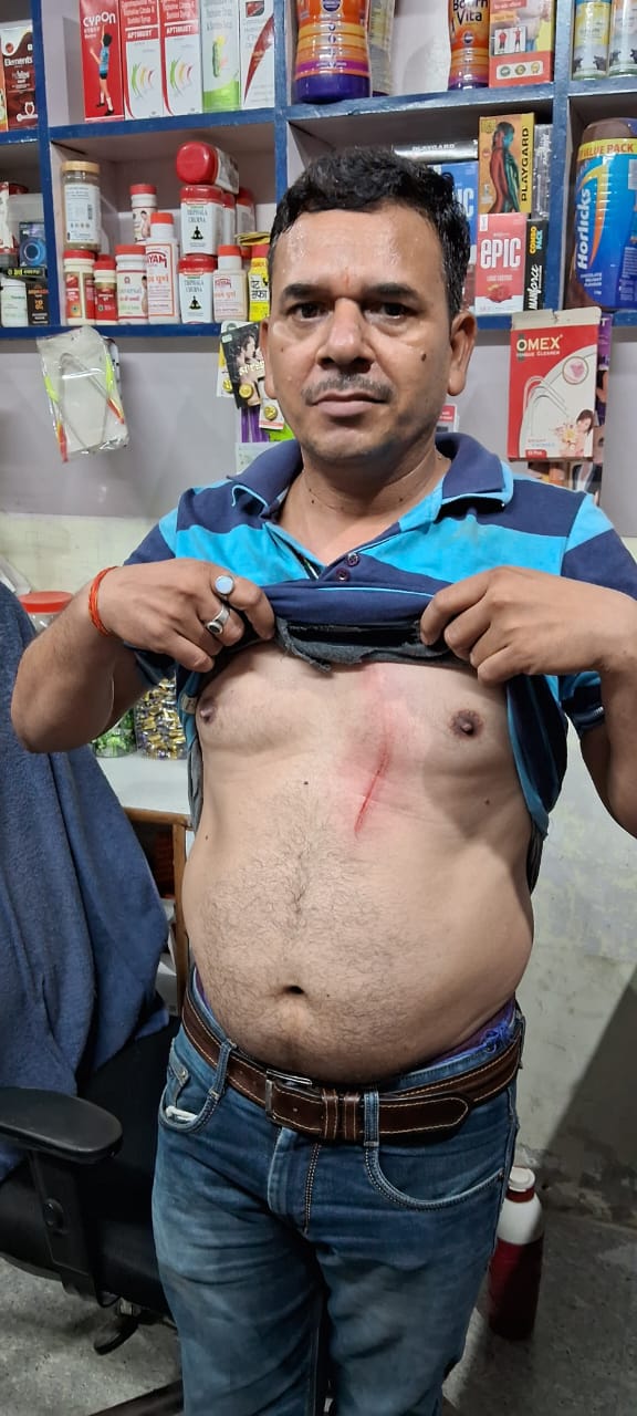 बरेली - सांड ने प्रधानाध्यापक और नगर पंचायत सफाई कर्मचारी को सींग मारकर किया घायल।