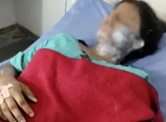 पीलीभीत के डॉक्टर के बेटा- बेटी पर फेंका तेजाब , घर में सो रहे थे डॉक्टर के बेटा- बेटी, पुलिस ने दोनों को अस्पताल में भर्ती कराया