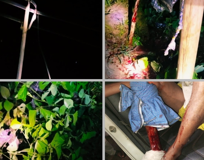 बरेली - बड़ागांव चौकी क्षेत्र में बिजली विभाग के कर्मचारियों की लापरवाही के चलते हुआ हादसा एक व्यक्ति बुरी तरह हुआ जख्मी।