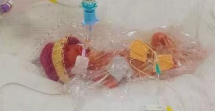 कुदरत का चमत्कार, 4 महीने की प्रेग्नेंसी में बच्ची का जन्म, वजन देख डॉक्टर भी हुए हैरान