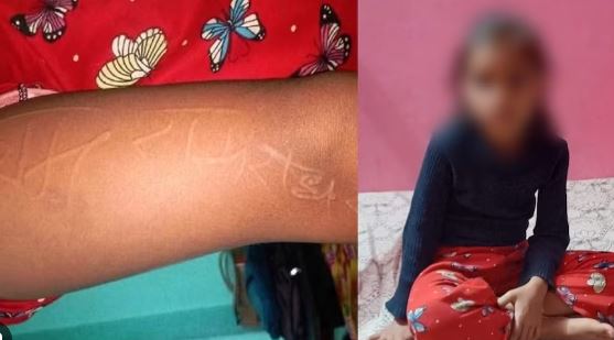 हरदोई में बच्ची के शरीर पर उभर रहे राम और राधे नाम का शब्द,डॉक्टर भी हैरान