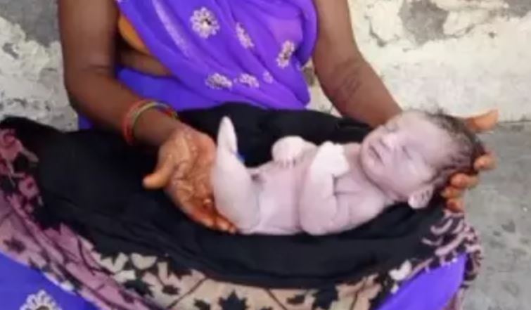 पीलीभीत में मछली जैसी आकृति का बच्चा जन्मा, एक घंटे में मौत