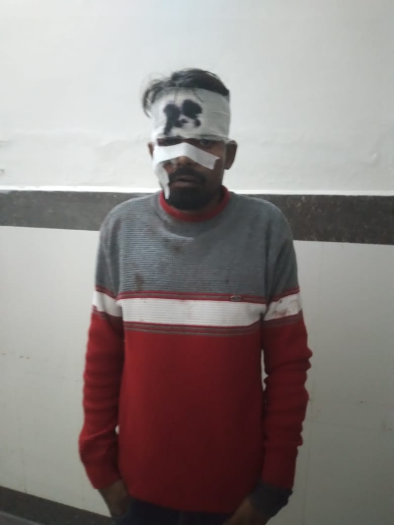 बरेली - बाल काटने को लेकर हुए विवाद में नाई ने उस्तरे से किया हमला पीड़ित ने कराई रिपोर्ट दर्ज।