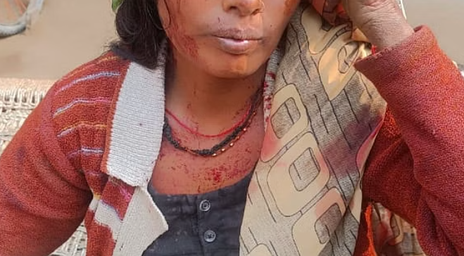 पीलीभीत में बाघ के हमले में महिला गंभीर रूप से घायल