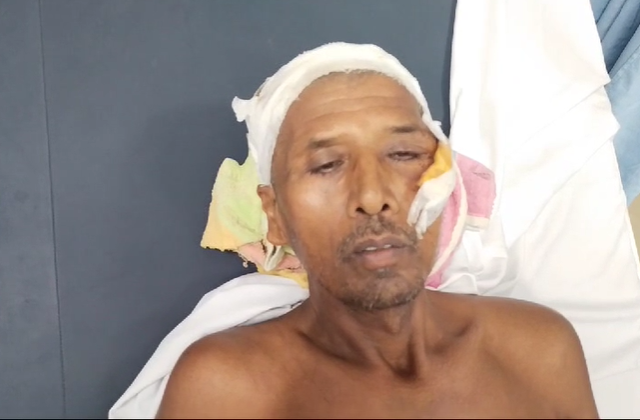 रायबरेली में दबंगो ने शराब पीकर दुकानदार रजनू पर किया जानलेवा हमला , हमले से हुआ पीड़ित बुरी तरह जख्मी एम्स में लड़ रहा मौत की जंग।