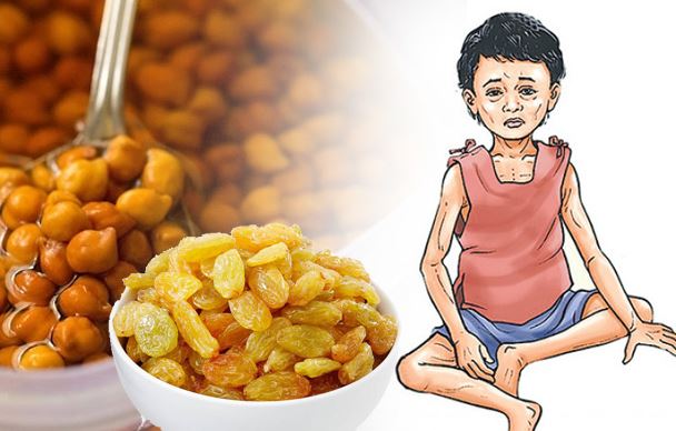नीति आयोग ने कहा पोषण के मामले में गुजरात का प्रदर्शन रहा खराब , 40 फीसदी बच्चे हैं कुपोषित