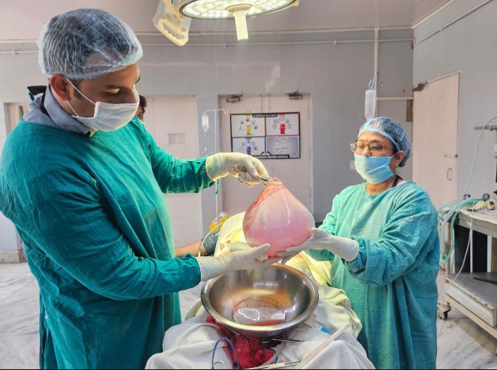 फर्रुखाबाद: केबल 70 रूपये खर्च में नई जिन्दगी दी लोहिया के सर्जन मेजर डा. रोहित तिवारी नें 10 किलो का ट्यूमर निकालकर।
