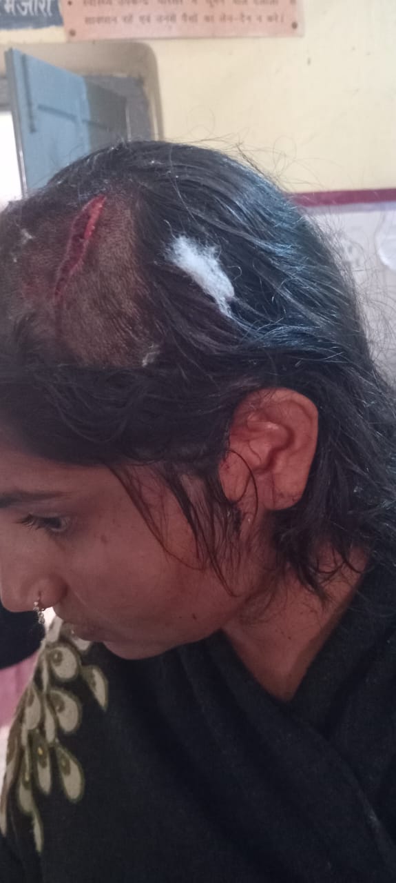 रायबरेली : भारी पड गया दिन रात पीडितो को दभंगो ने घर में घुसकर की मारपीट