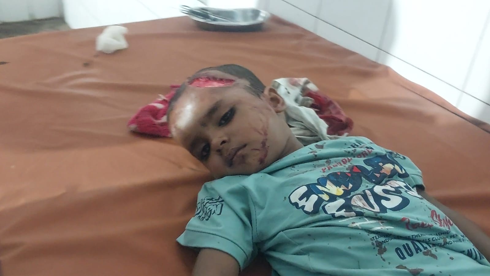 पीलीभीत: शादी समारोह से घर वापस लौट रहे अचानक ई-रिक्शा पलटने से आठ लोग घायल