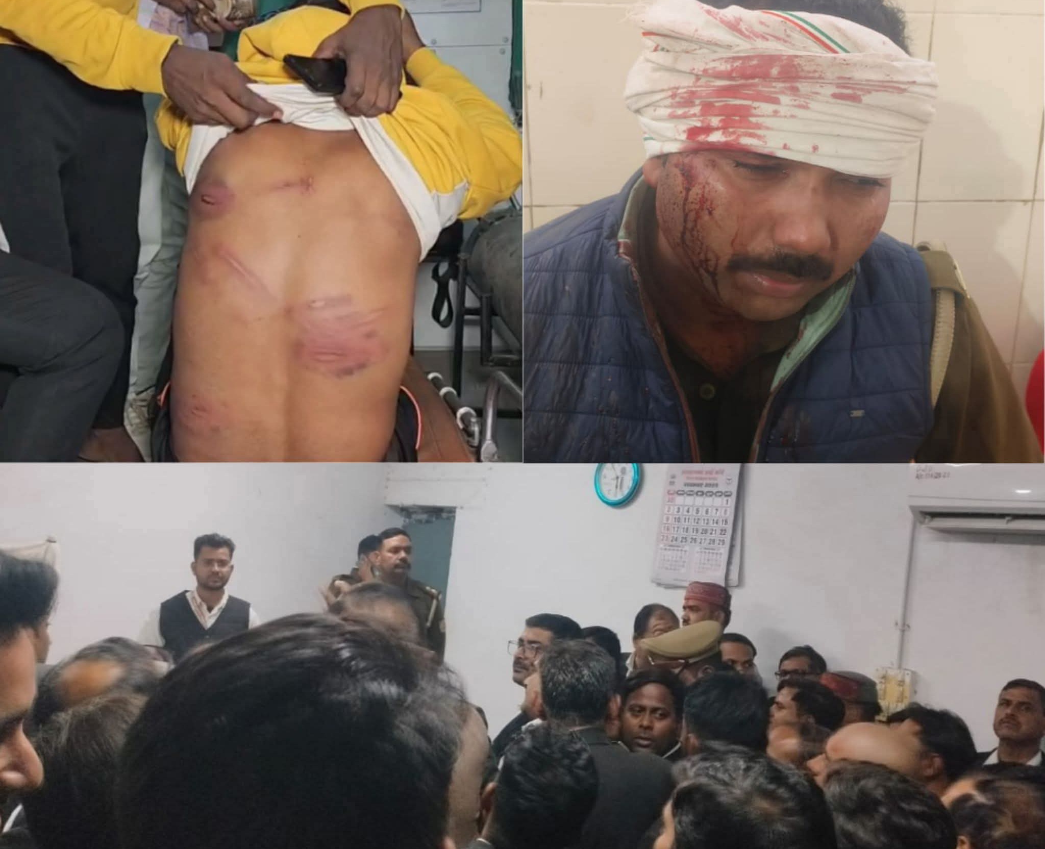 उन्नाव में अधिवक्ता की पिटाई से भड़के वकील, कोर्ट परिसर में पुलिसकर्मियों पर हमला – थाना प्रभारी सहित कई निलंबित