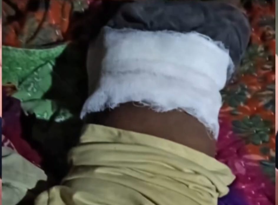 फर्रुखाबाद:गली में खेल रहे मासूम को ट्रैक्टर ने मारी टक्कर, गंभीर रूप से घायल- मां ने पुलिस अधीक्षक से न्याय की लगाई गुहार