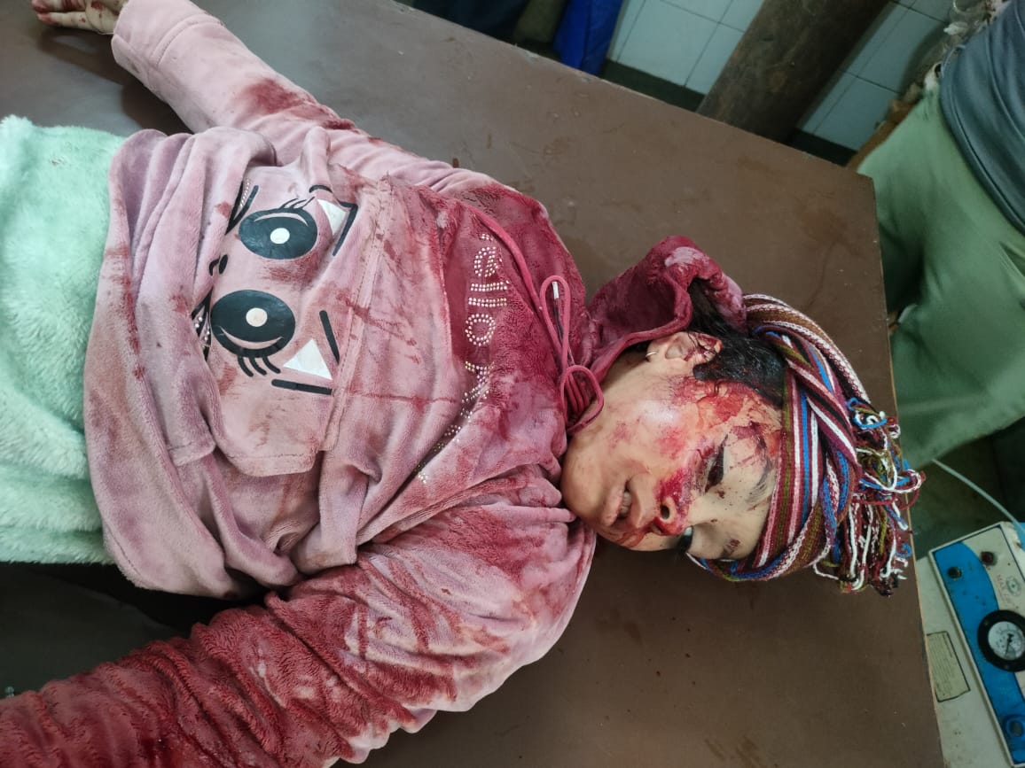 फर्रुखाबाद:लोकनिर्माण विभाग की लापरवाही बनी मौत का कारण, जसमई चौराहे पर मासूम बच्ची की दर्दनाक मौत।