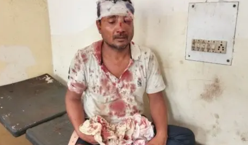 हरदोई : वरिष्ठ पत्रकार विनोद कुमार कुशवाहा पर हुए हमले के बाद गिरफ्तार नहीं हुए अपराधी ? सामाजिक संगठन ने उठाई आवाज