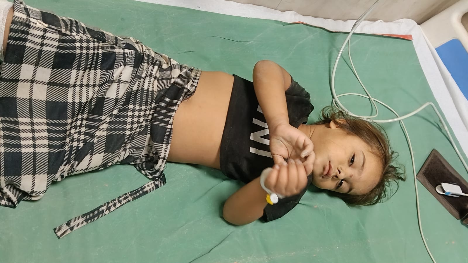 फर्रुखाबाद:स्वास्थ्य विभाग, प्रशासन, रेस्क्यू टीम और चिकित्सकों की तत्परता से मासूम को मिला नया जीवन