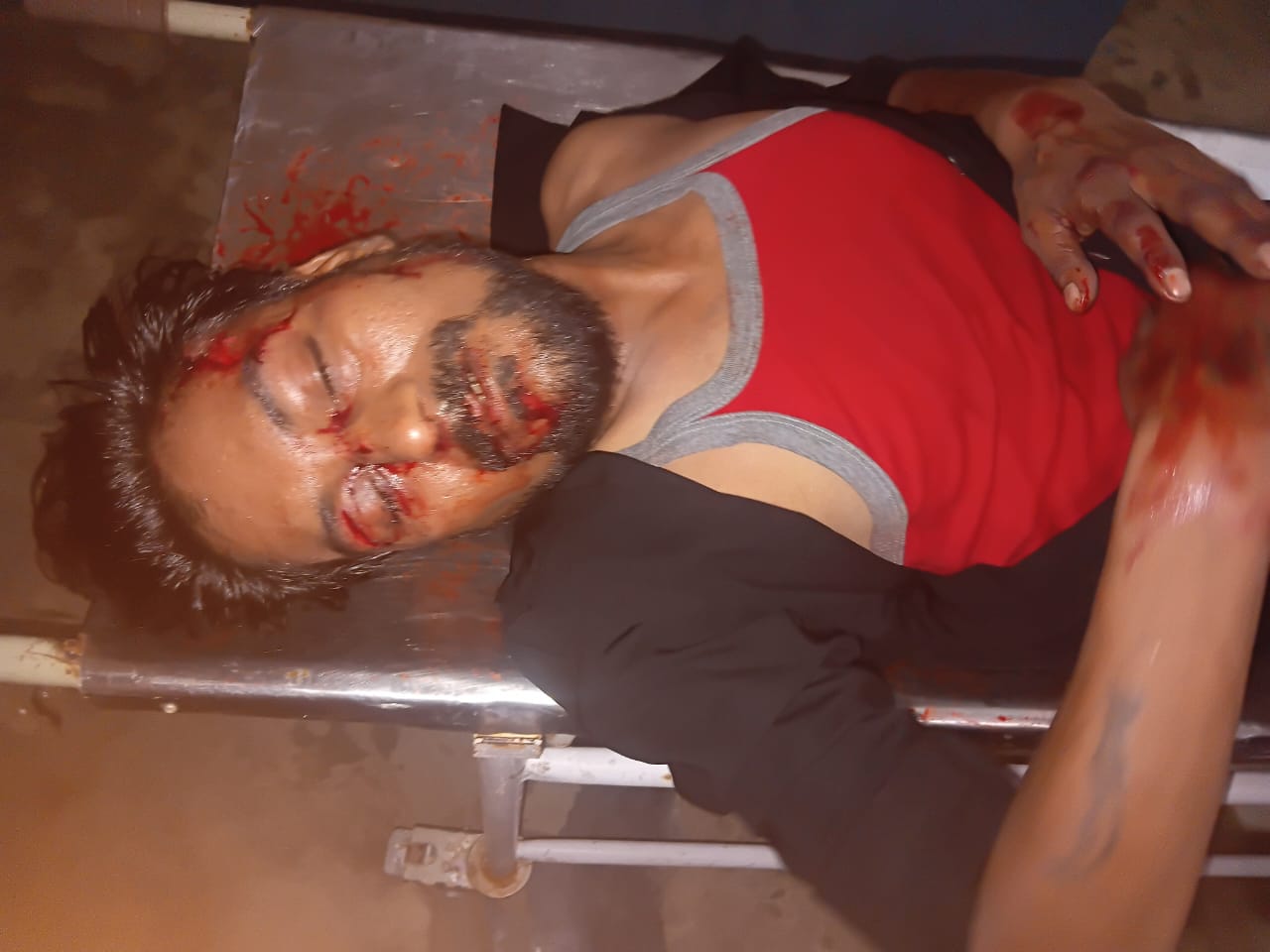 बरेली/आंवला-शाहाबाद रोड हरदासपुर के पास कंटेनर और बाइक में भीषण टक्कर, बाइक सवार गंभीर रूप से घायल।
