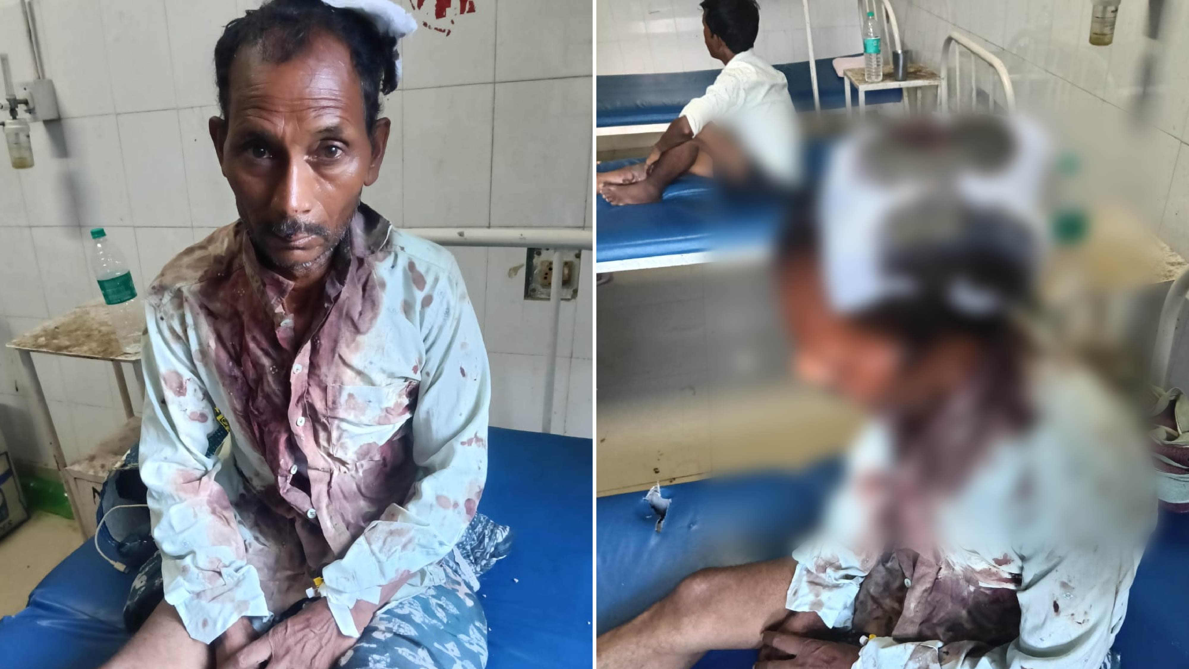 खेत की मेड़ तक पहुंची भैंस तो भिड़े दो पक्ष, कुल्हाड़ी के वार से पिता गंभीर